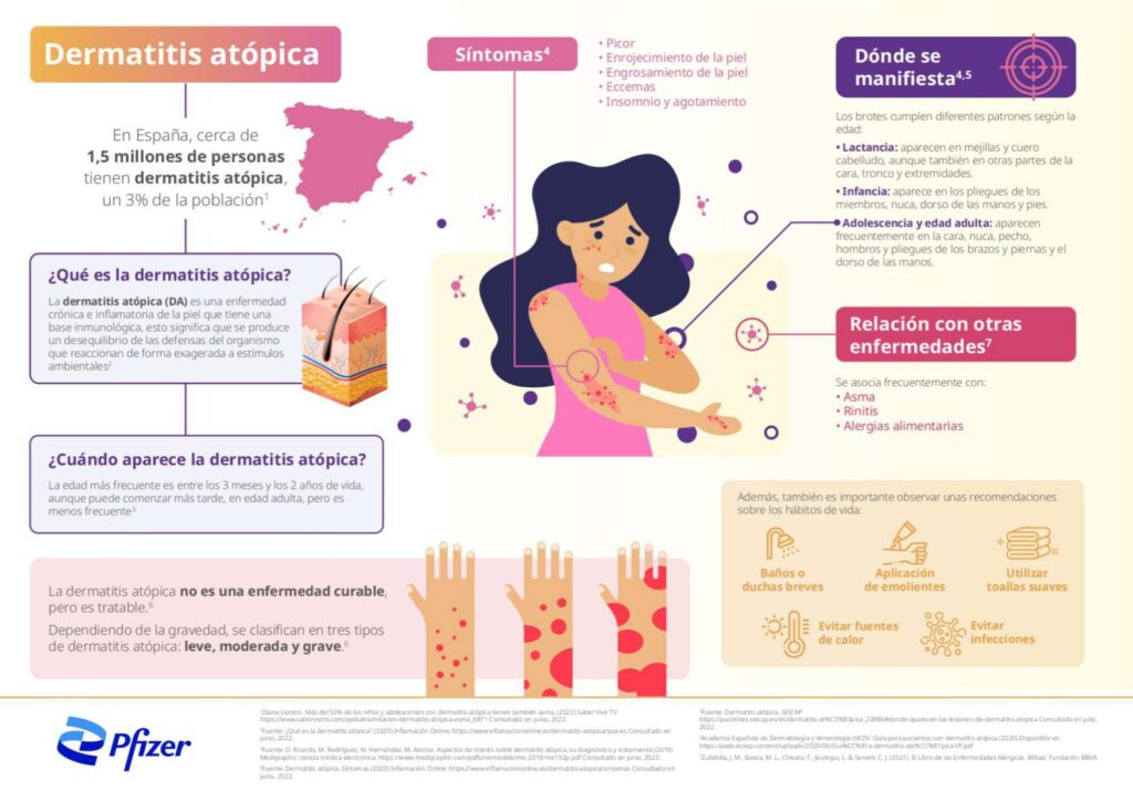 Pfizer Infografia dermatitis atopica